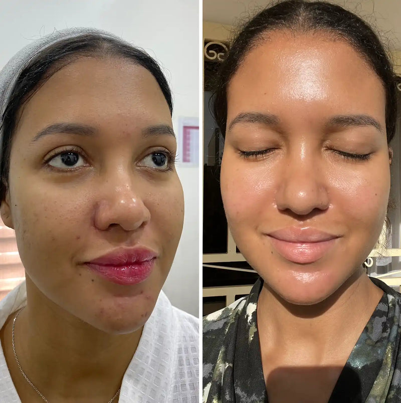Side-by-side comparison of a woman’s face with eyes open and closed.